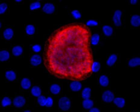 Malaria Infection in Stem Cell-Derived Liver Cells