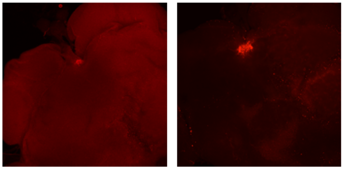 Insulin mRNA in ant brains
