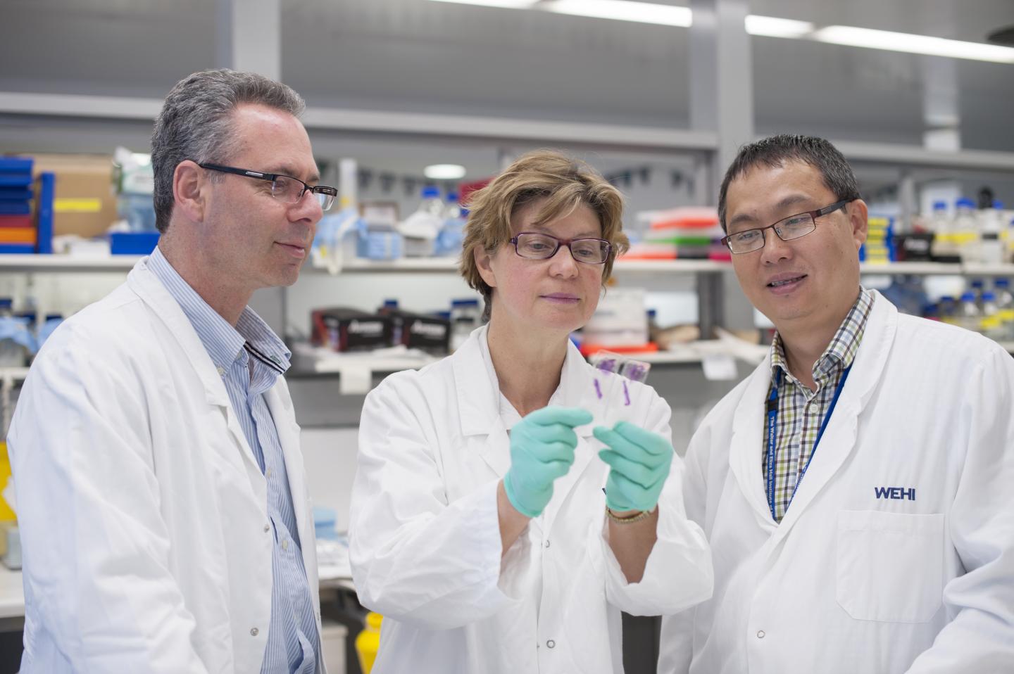 Jane Visvader, Nai Yang Fu and Geoff Lindeman, Walter and Eliza Hall Institute