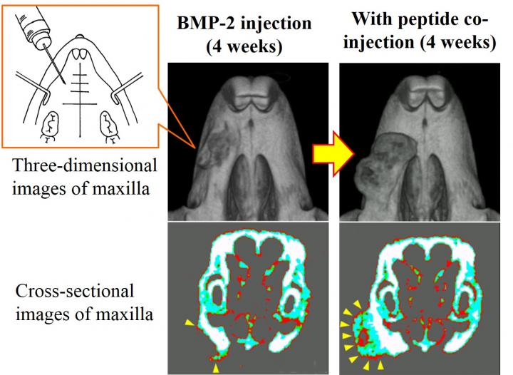 世界初、手術が不要の注射による簡便な顎骨造成をマウスで成功 