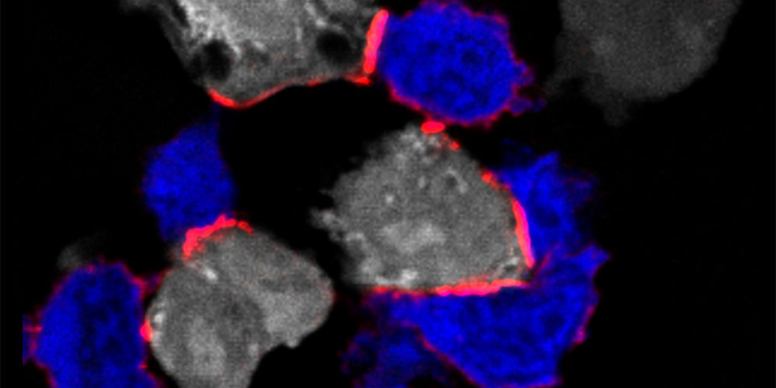 T cells (blue) attacking tumor cells (white)