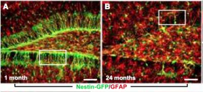 Age-dependent Alterations in the Numbers of Adult Brain Stem Cells and Astrocytes