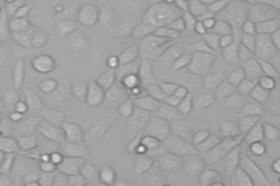 Pancreatic Cancer Cells
