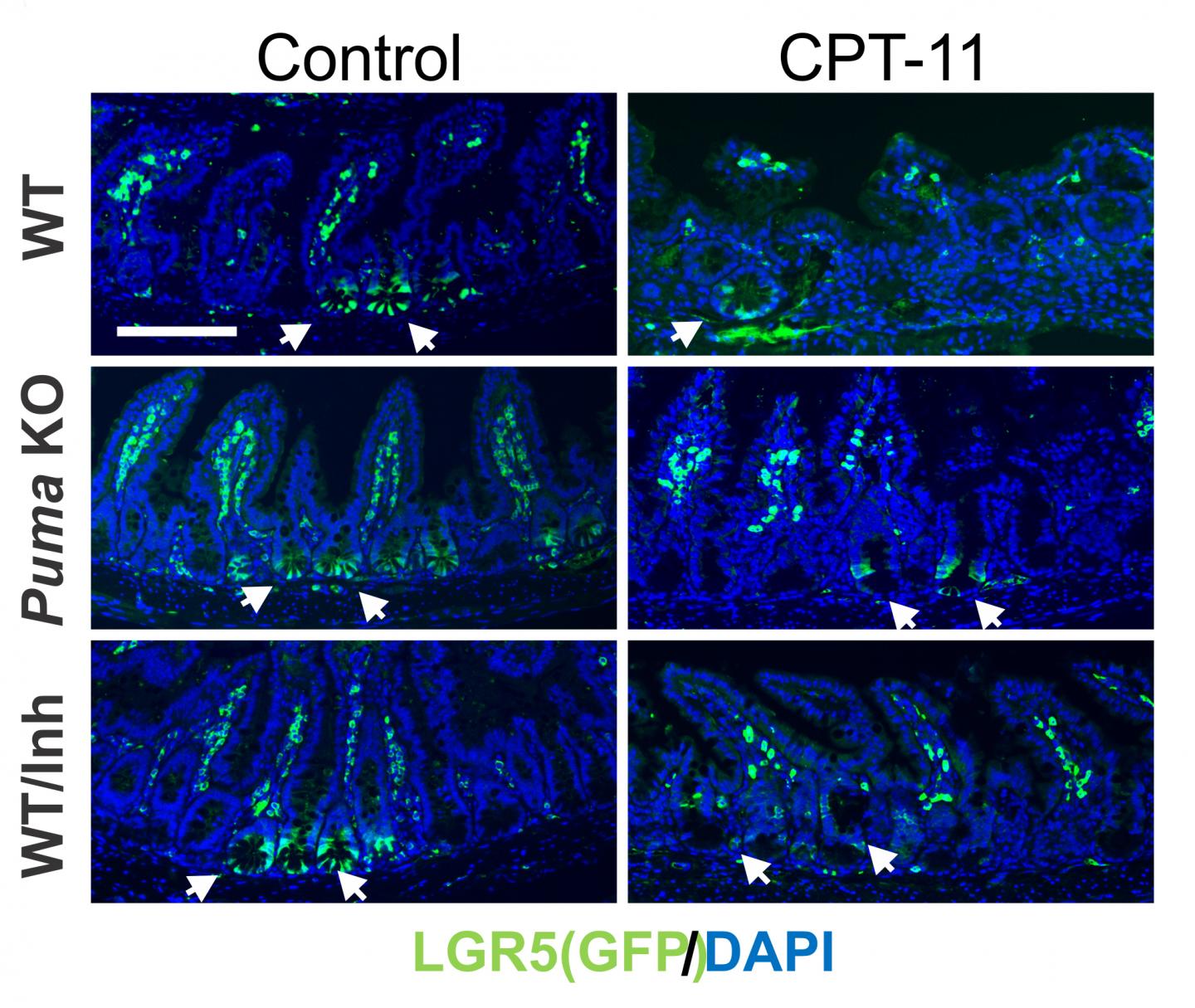 Protecting the Intestines from the Ravages of Chemotherapy (4 of 4)