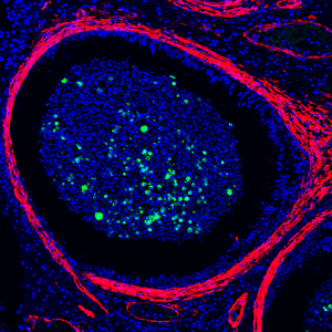 Researchers Detect Monkeypox Virus in Testes of Nonhuman Primate Survivors