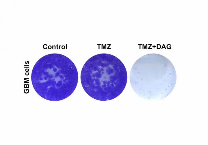 TMZ+DAG glioblastoma