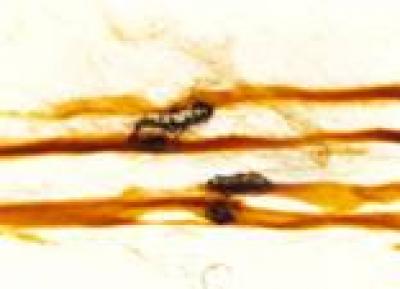 Repaired Artifical Nerves