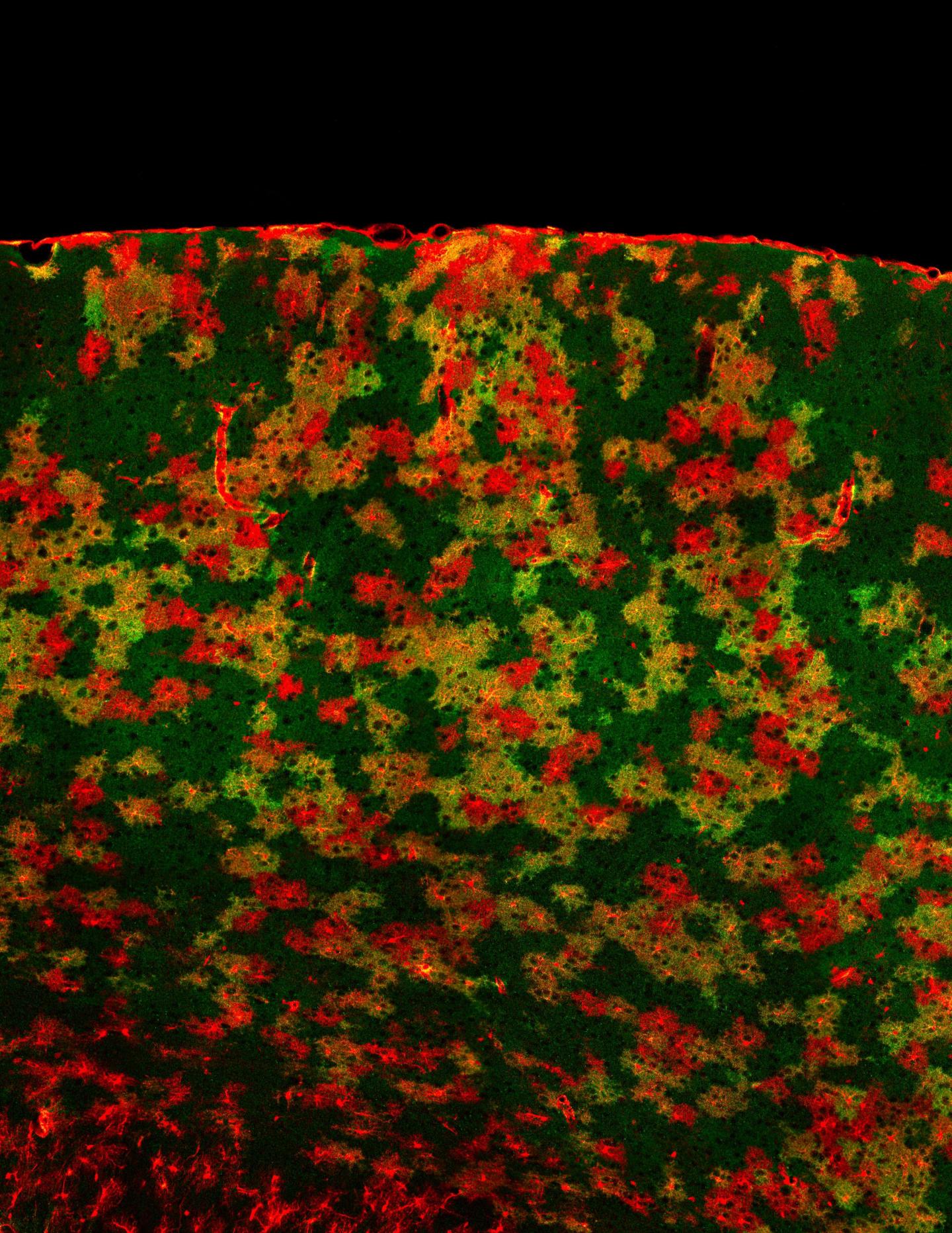 Neighboring Neurons Dictate the Role of Astrocytes (2 of 2)