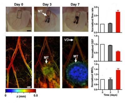 An Early Warning of Cancer?