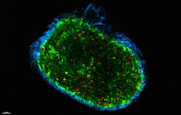 Red Cells in a Sea of Green: T Cells Exit Tumours and Move to Lymph Nodes, other Tumors