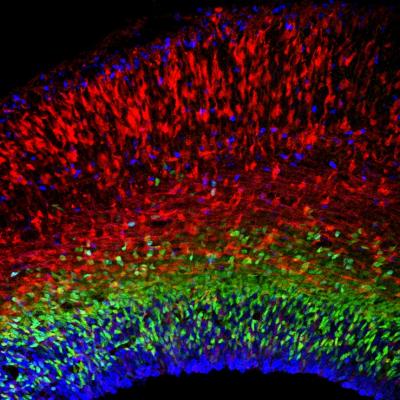 A Detailed Atlas of the Developing Brain
