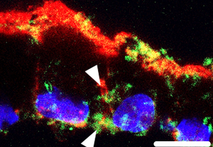 Stem-cell generated RPE