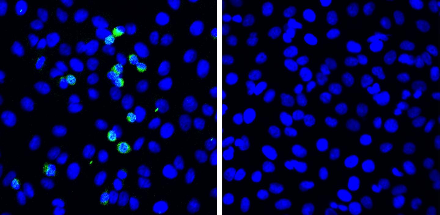 SARS-CoV-2 replication is suppressed by RIG-I