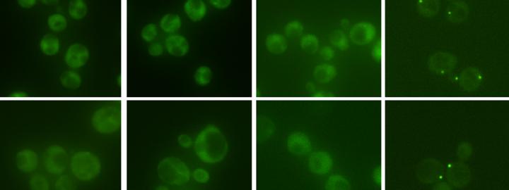 Stress Granules and P-Bodies