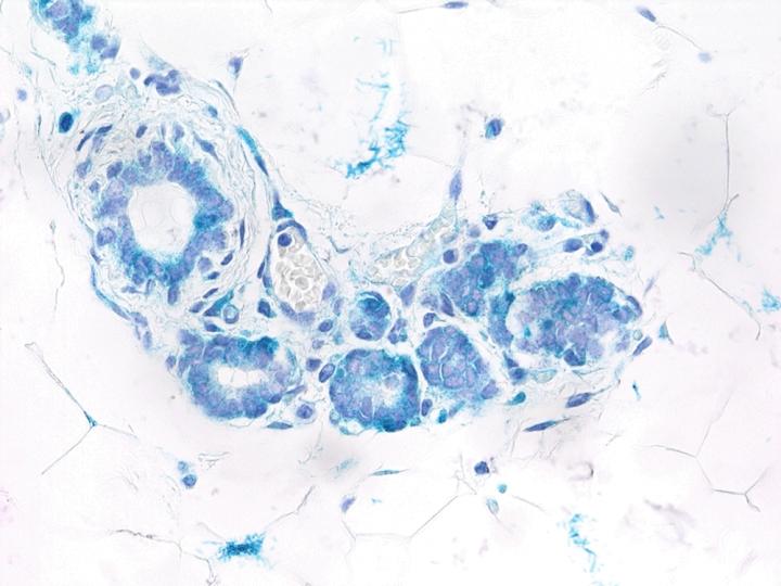 Senescent epithelial cells (cyan) in a mouse mammary gland with high levels of RANK protein.