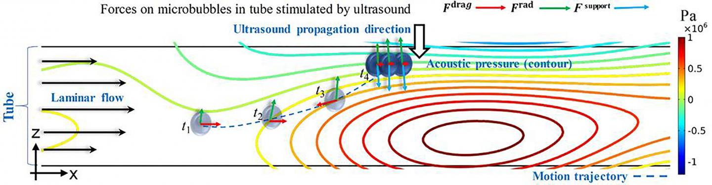 2D Schematic Diagram of Forces on Microbubbles in the Tube Stimulated by Ultrasound