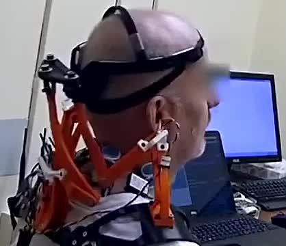 Video Illustrating Robotic Neck Brace