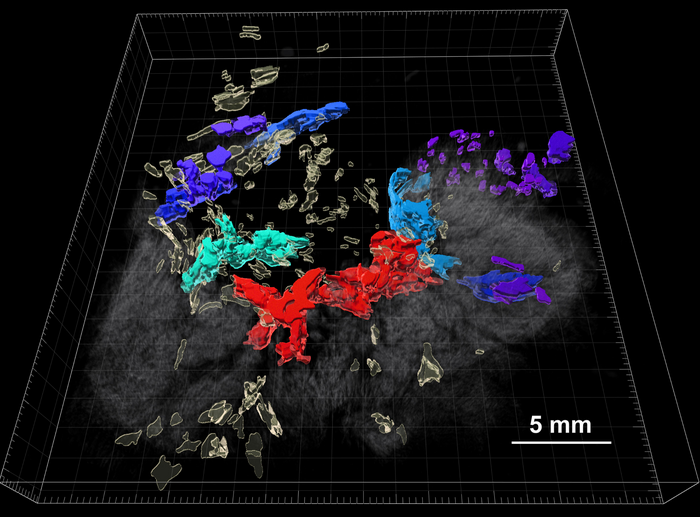 D Reconstruction Of Colorecta Image Eurekalert Science News Releases