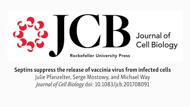 Francis Crick Institute Researchers Discover that Infected Cells Can Trap Viruses in Protein Cages