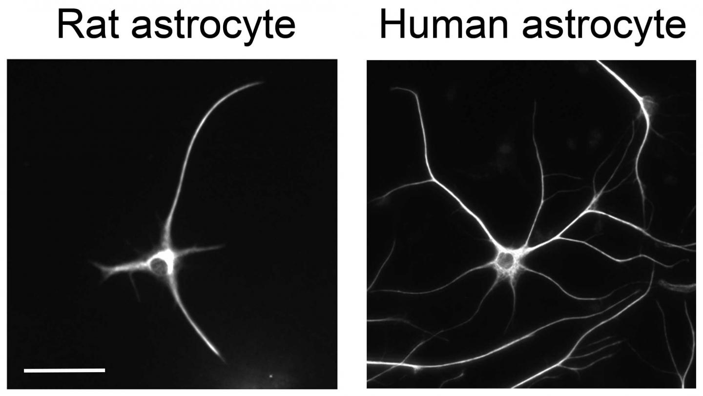 Rat And Human Astrocytes
