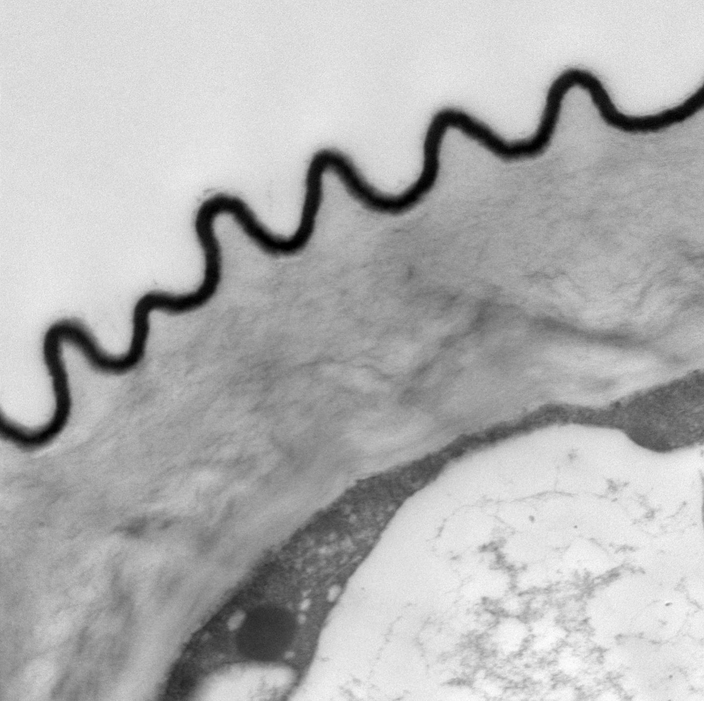 <i>Ursinia speciosa</i>: Microscopic Petal 'Striations' -- Side View