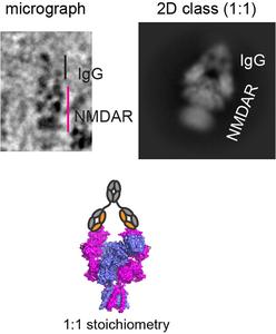 Antibody and NMDAR pattern