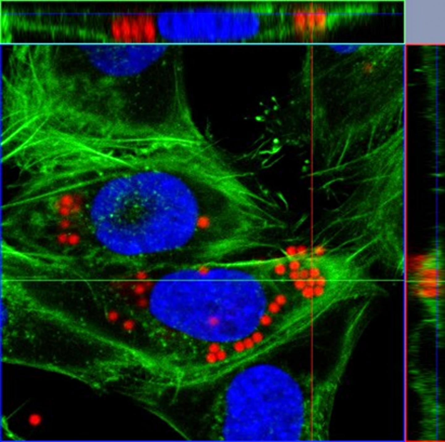 Cancer Cell Aggressiveness, Measured by Ability to Absorb Small Particles, May Assist Diagnosis (2 of 8)