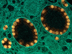 SARS-CoV-2 virus particles