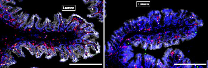 Colons of conventional and germ free  mice