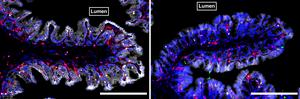 Colons of conventional and germ free  mice