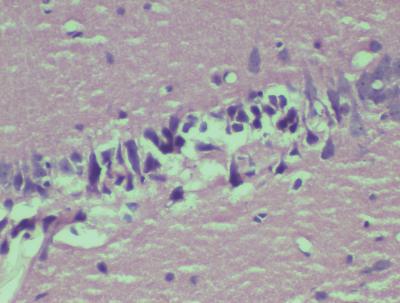 Hematoxylin-Eosin Staining, Neuronal Loss