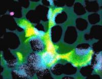 Microglial Cell Consuming Photoreceptors