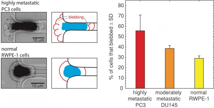 Images of a Blebbing, Highly Metastatic PC3 Prostate Cancer Cell
