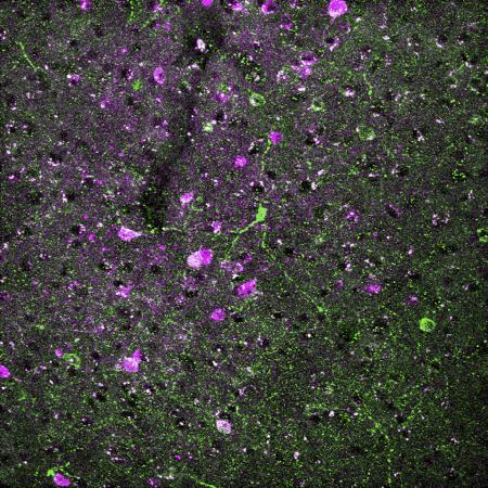 green and pink neurons