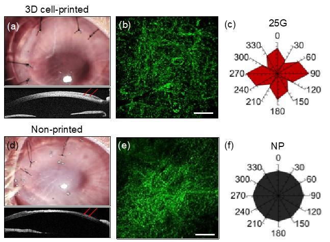 3D Cell-Printed and Non-Printed Corneal Implants