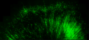 Specific tagging of brain cells