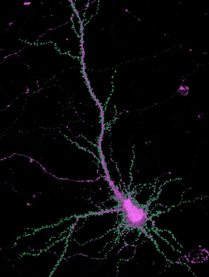Syngap in a Hippocampal Neuron