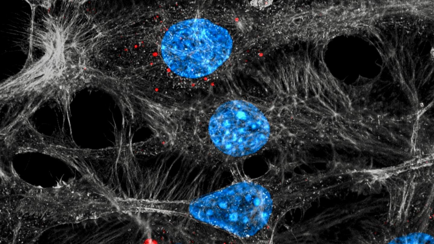 Endothelial Cells Internalizing Exosomes Released From Chemotherapy-treated Tumors