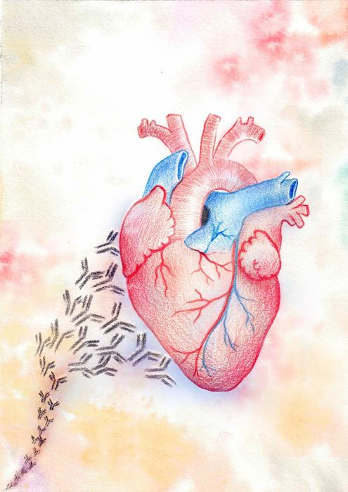 Hand-drawn: Autoantibodies attacking the heart in lupus patients