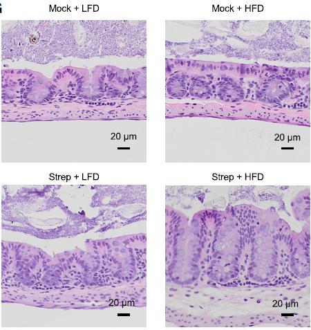 Sections of the Colon's Inner Lining