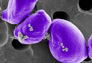 FcMBL-mediated pathogen capture from pediatric blood samples