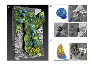 Nano-XPCT analysis of the Paneth and goblet cells