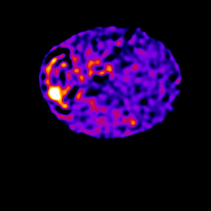 First Ever Images of the Cell-Wide Web Reveal the Circuit that Directs Signals inside Cells (1 of 2)