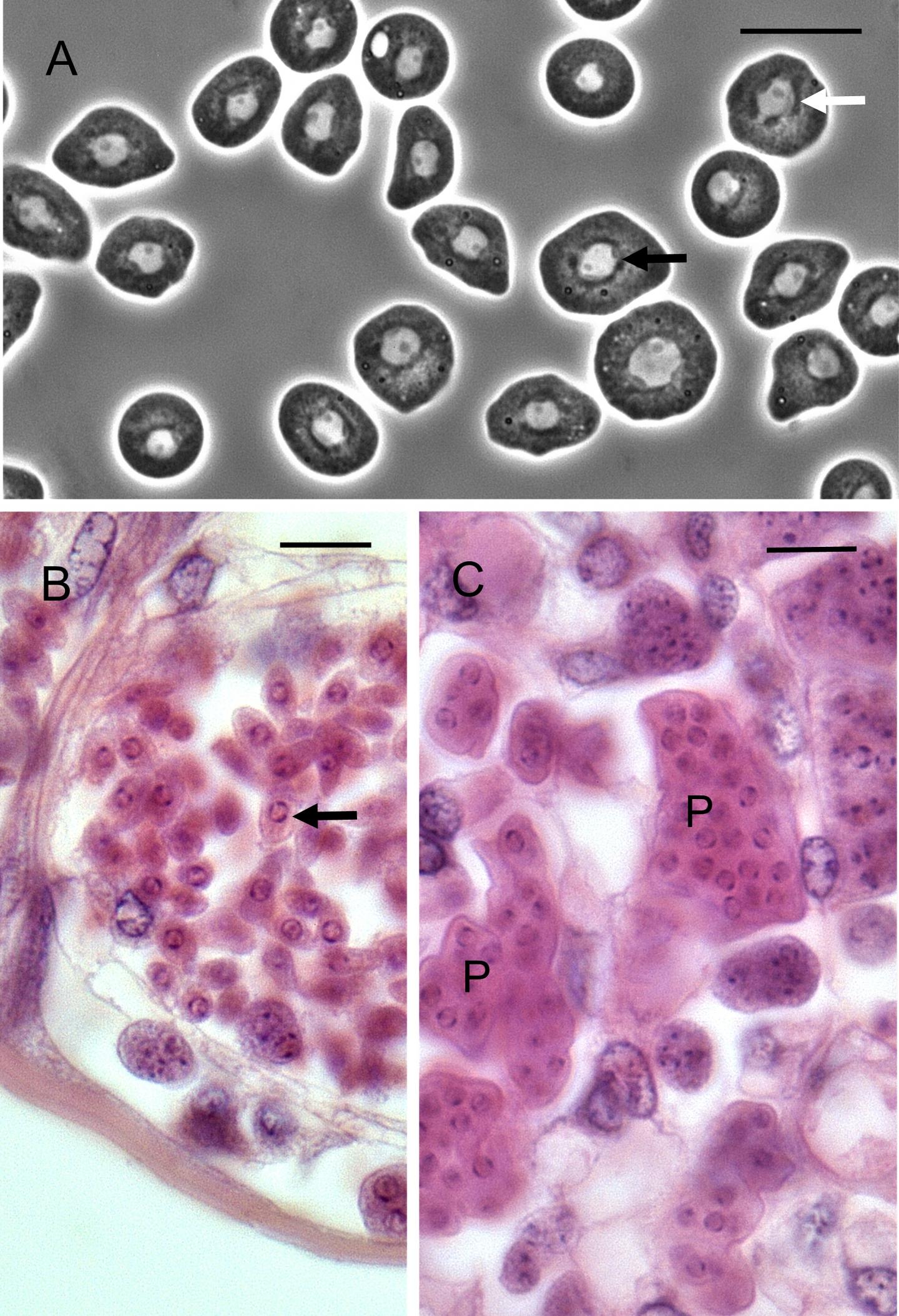 Haplosporidium Cranc Infection of a Shore Crab