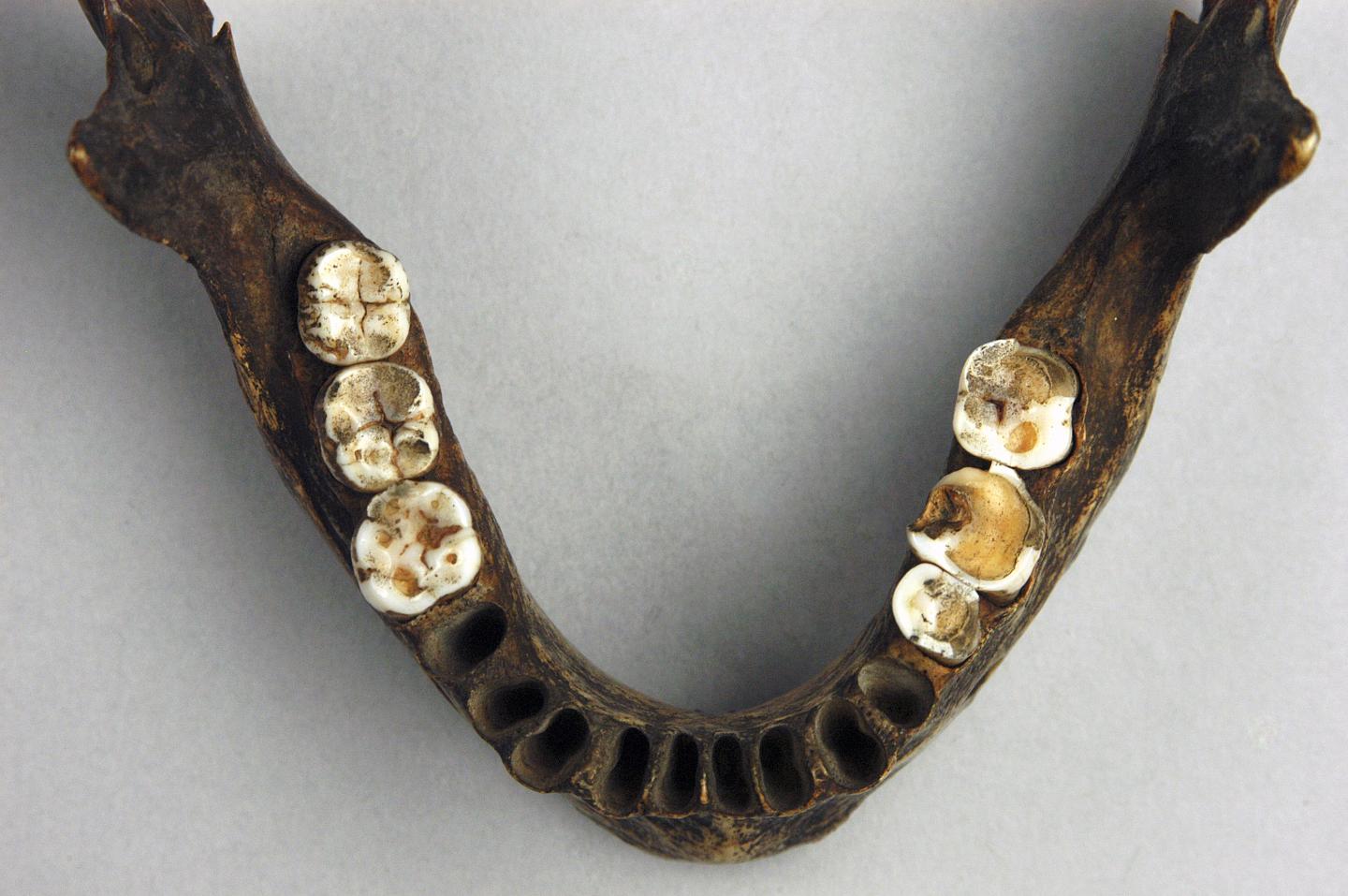 Archaeological Mandible and Teeth
