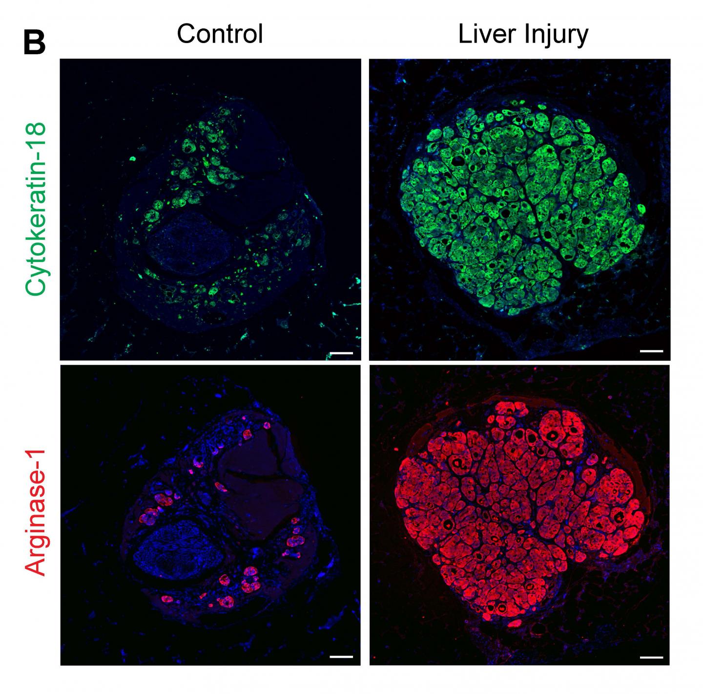 Organ SEEDs Grow New Liver Tissue (3 of 4)