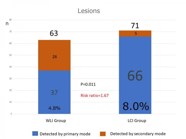 Patient-Based Results: Neoplastic Lesions Detected Using WLI and LCI in the primary and Secondary Modes