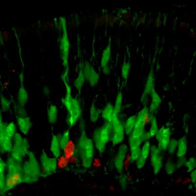 Differentiating Olfactory Neurons