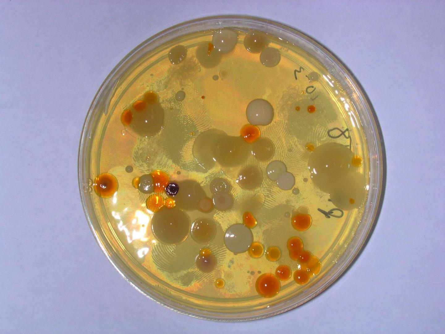 Dormancy in Microbial Communities