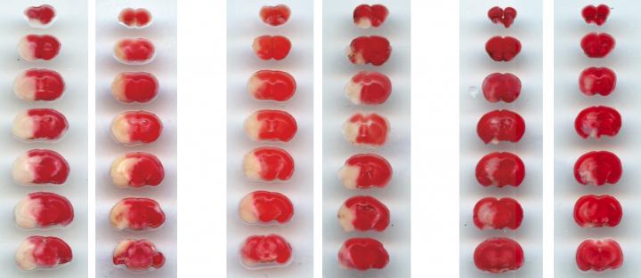 Mitigating Tissue Damage after Stroke